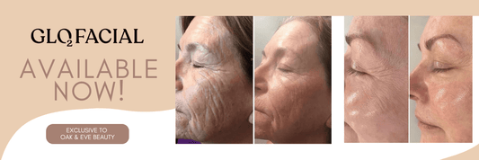Exclusive Glo2 Super Facial - your ultimate skin treatment - Oak & Eve Beauty 