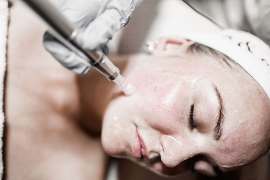 Why Skin Needling Is the Ultimate Skin Rejuvenation Treatment at Any Age - Oak & Eve Beauty 